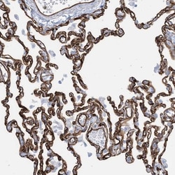 EPS8L3 Antibody, Novus Biologicals 25 &mu;L, Unlabeled:Antibodies, Polyclonal